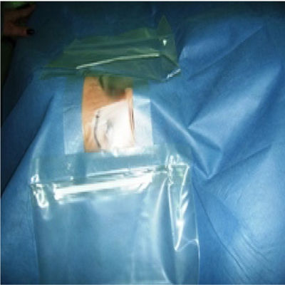 Okulistyka Wielowarstwowe sterylne serwety chirurgiczne z woreczkiem